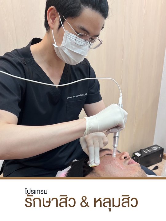 โปรแกรมรักษาสิว & หลุมสิว
