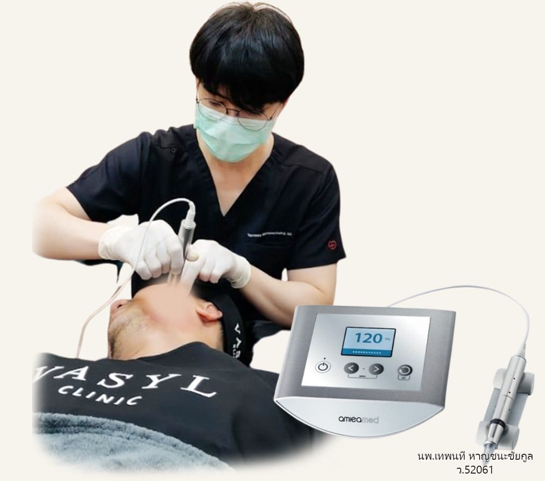 นพ.เทพนที หาญชนะชัยกูล (หมอวิว) ทำหัตถการรักษาหลุมสิวด้วยเครื่องมือแพทย์ที่ VASYL Clinic ขอนแก่น